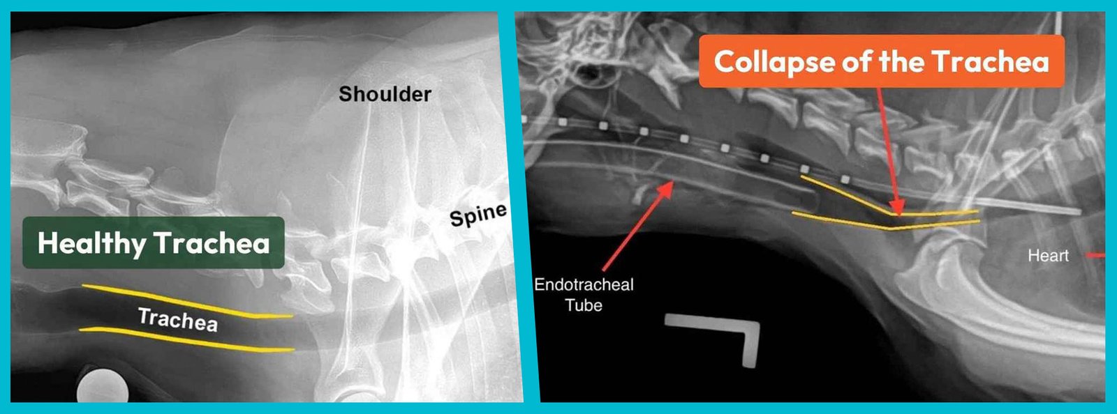 Comparative X-ray images showing a healthy trachea versus a collapsed trachea in small dogs, highlighting the importance of choosing the right collar to prevent injury.